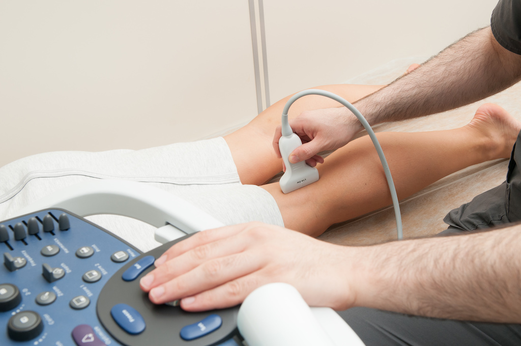 varicose veins diagnosis