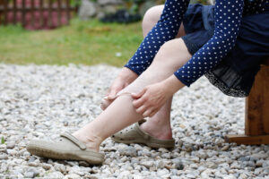 Woman with varicose veins applying compression bandage